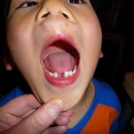 8-30-09-2 Up close
